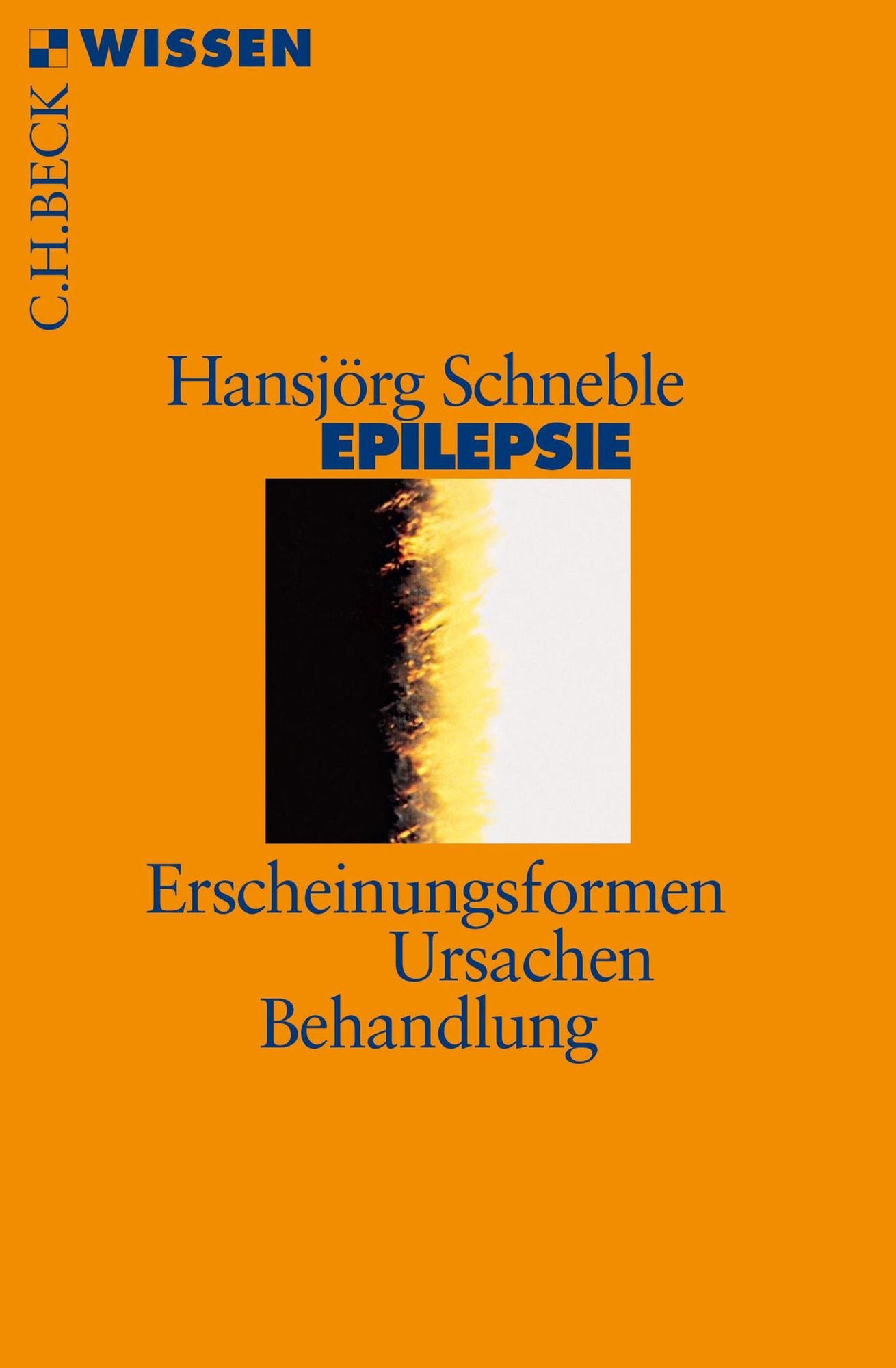 Epilepsie: Erscheinungsformen, Ursachen, Behandlung
