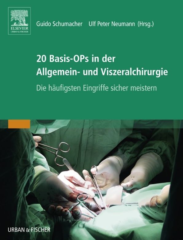 20 Basis-OPs in der Allgemein- und Viszeralchirurgie: Die häufigsten Eingriffe sicher meistern