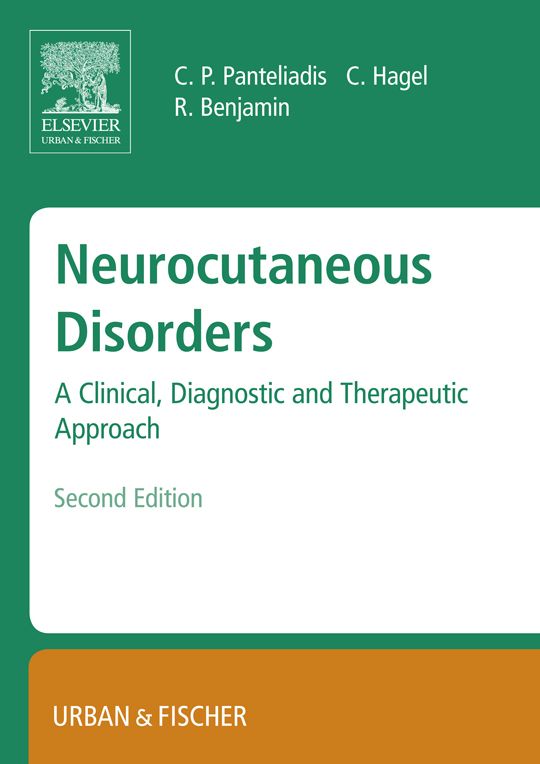 Neurocutaneous Disorders: A Clinical, Diagnostic and Therapeutic Approach