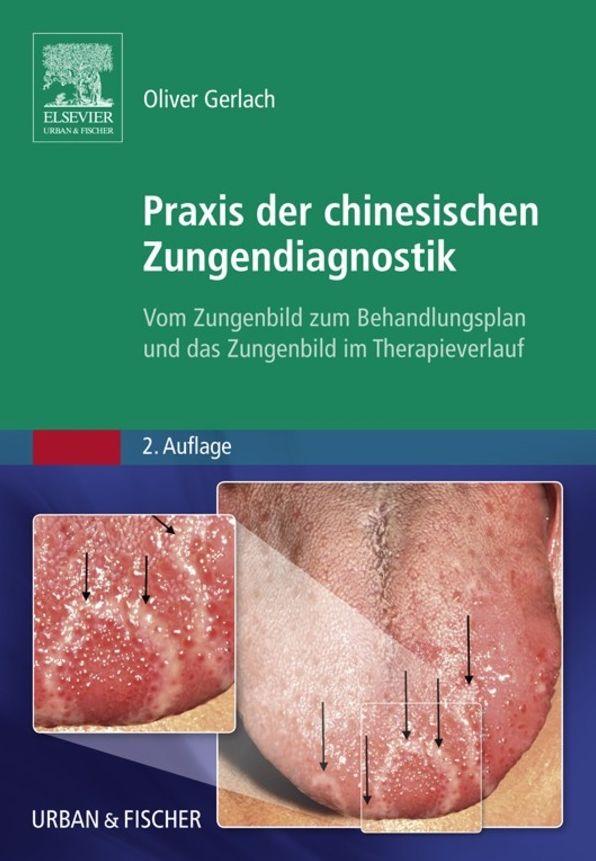 Praxis der chinesischen Zungendiagnostik: Vom Zungenbild zum Behandlungsplan und das Zungenbild im Therapieverlauf