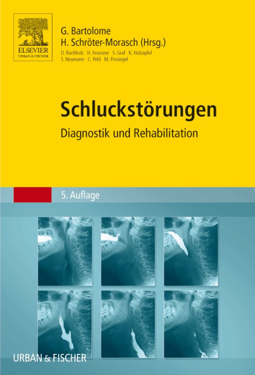 Schluckstörungen: Diagnostik und Rehabilitation