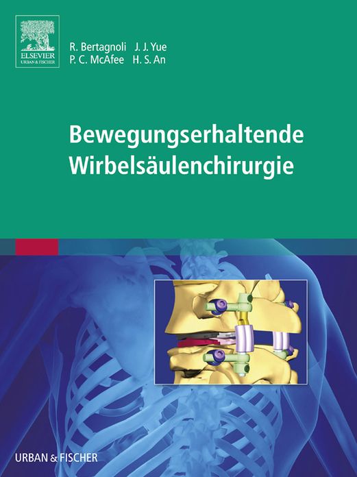 Bewegungserhaltende Wirbelsäulenchirurgie