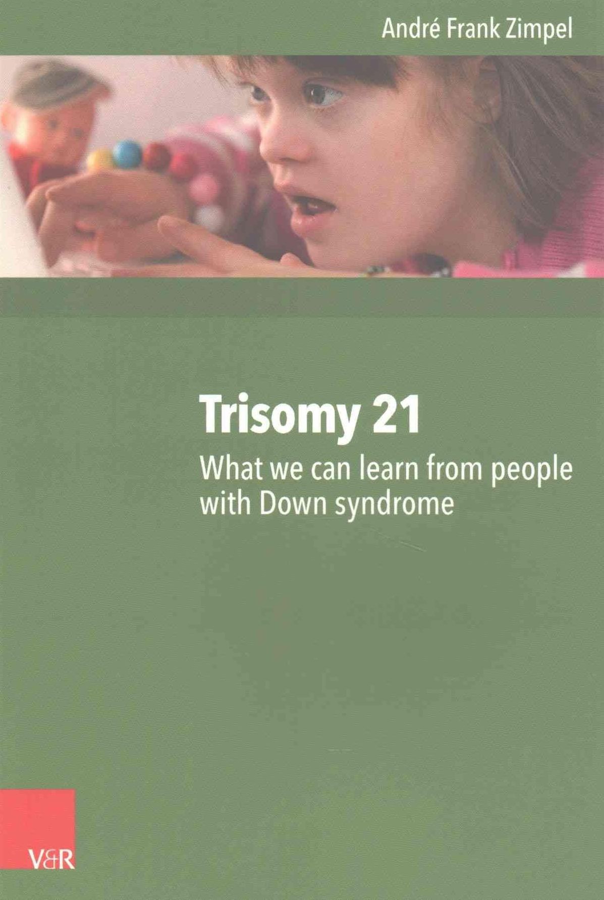 Trisomy 21: What we can learn from people with Down syndrome
