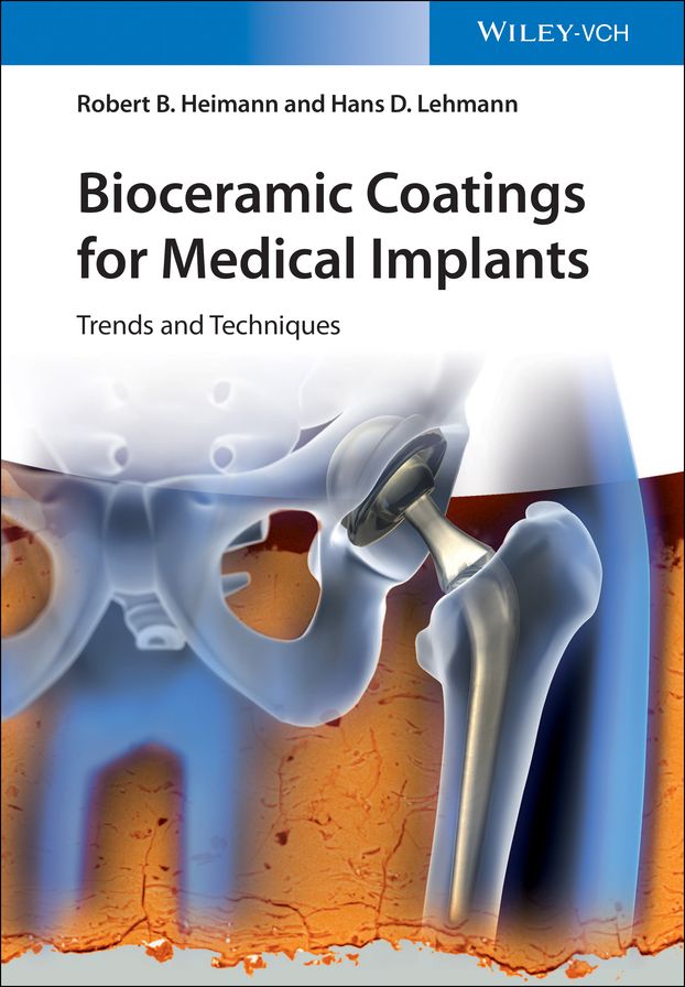 Bioceramic Coatings for Medical Implants: Trends and Techniques