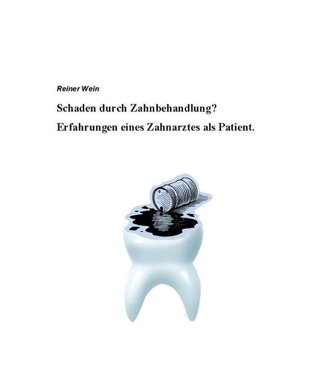 Schaden durch Zahnbehandlung? Erfahrungen eines Zahnarztes als Patient.