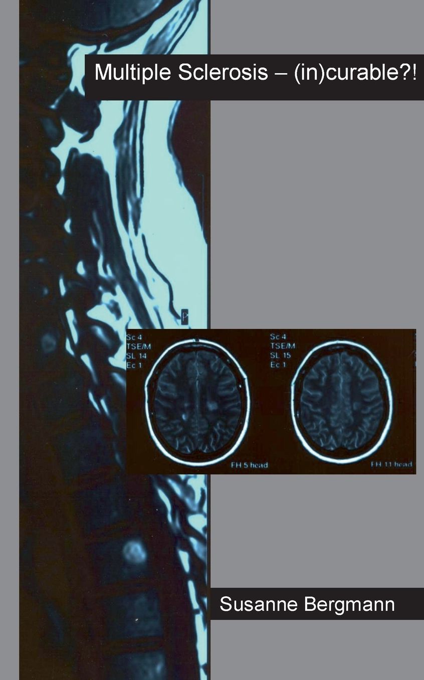 Multiple Sclerosis - (In)Curable?!