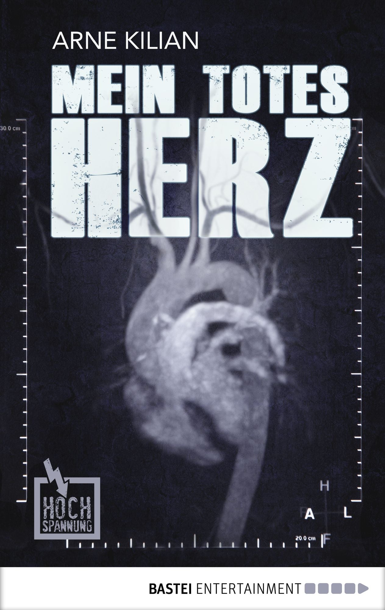 Mein totes Herz