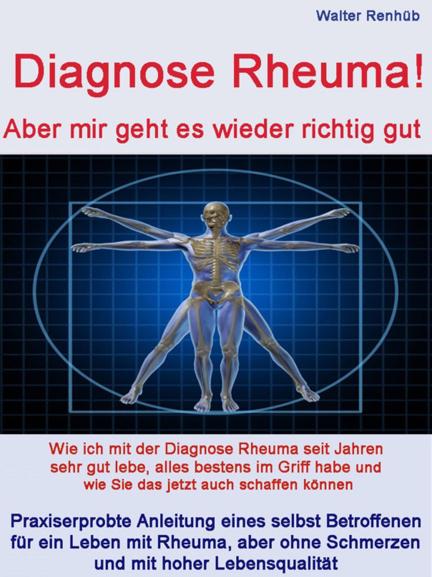 Diagnose Rheuma: Wie ich mit der Diagnose Rheuma seit Jahren sehr gut lebe, alles bestens im Griff habe und wie Sie das jetzt auch schaffen können