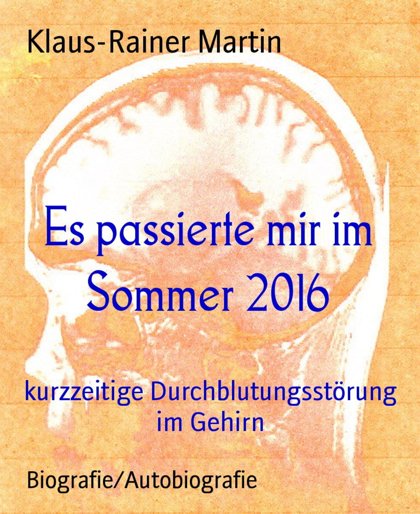 Es passierte mir im Sommer 2016: kurzzeitige Durchblutungsstörung im Gehirn