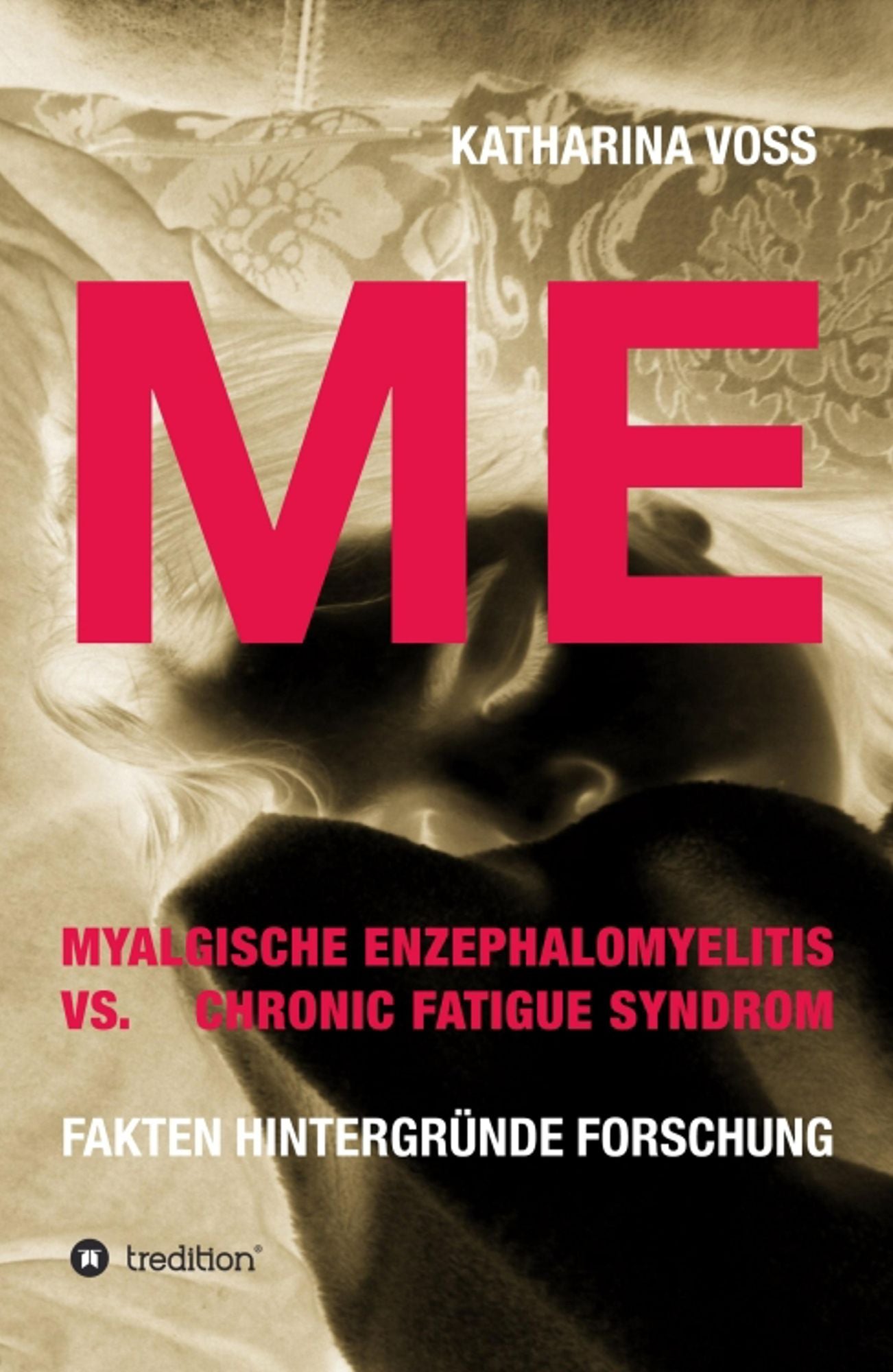 ME - Myalgische Enzephalomyelitis vs. Chronic Fatigue Syndrom: Fakten Hintergründe Forschung