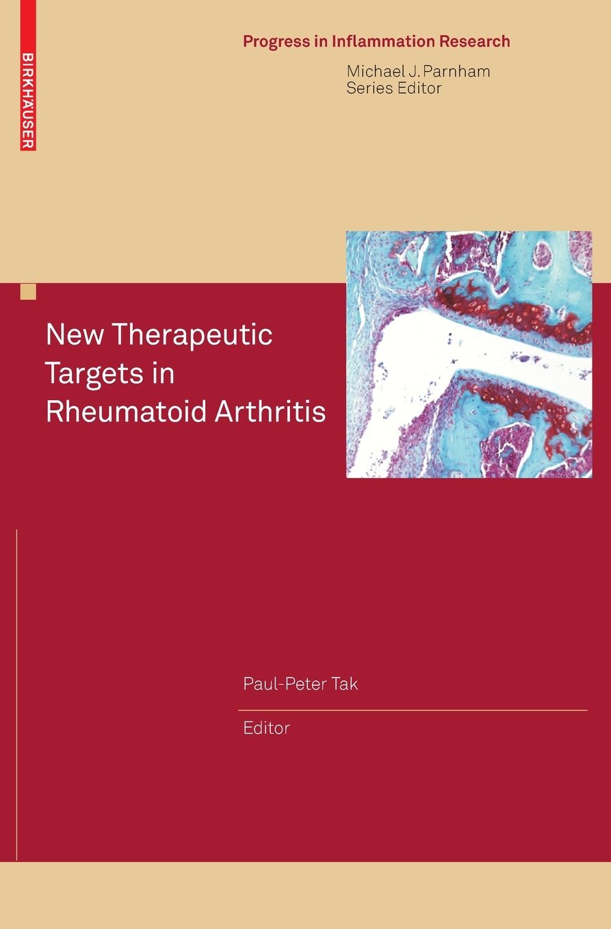 New Therapeutic Targets in Rheumatoid Arthritis