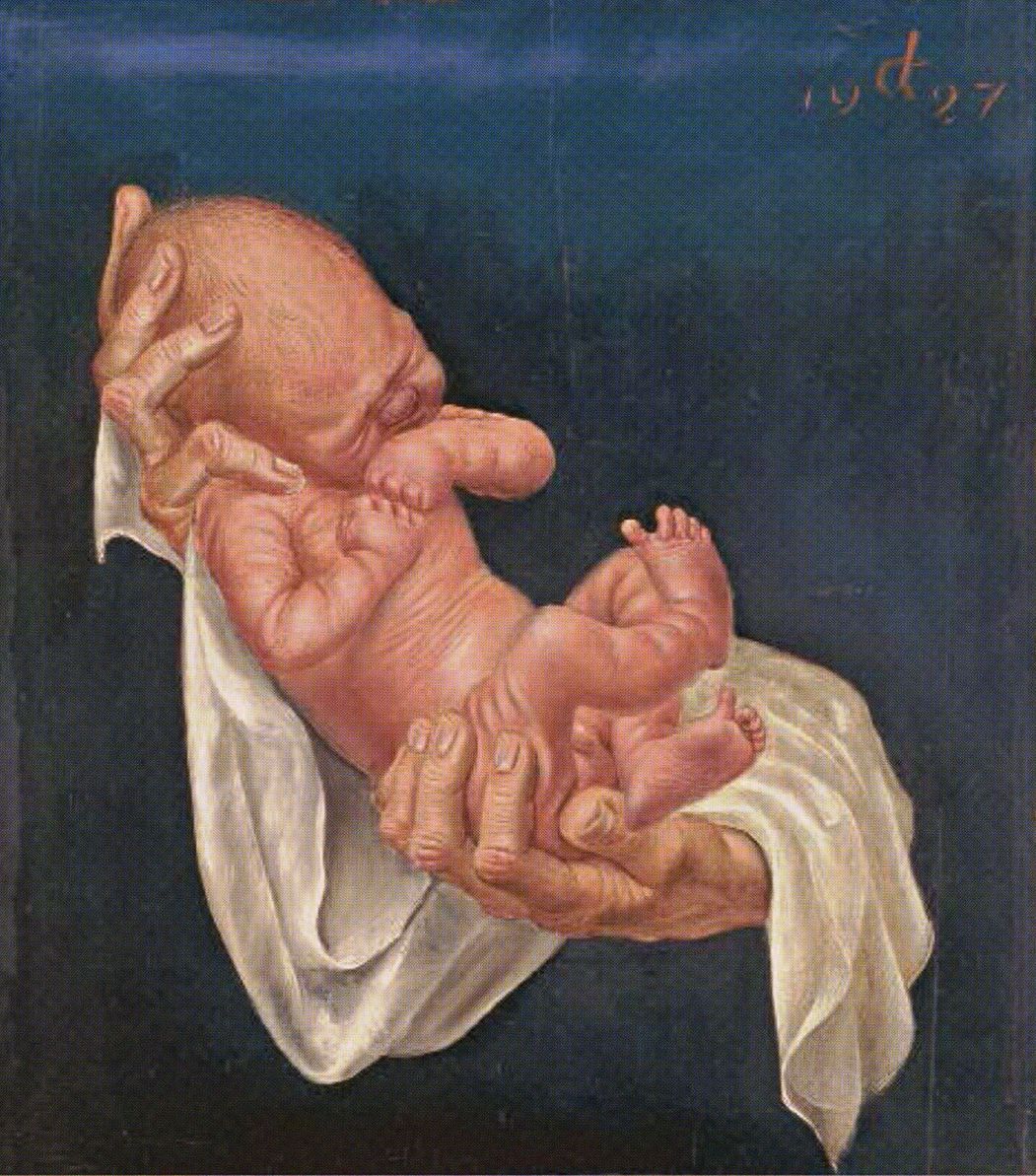 Otto Dix and New Objectivity