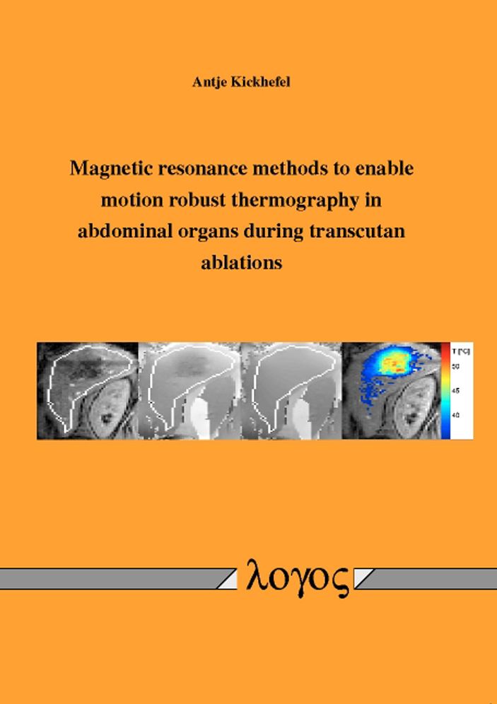 Magnetic resonance methods to enable motion robust thermography in abdominal organs during transcutan ablations