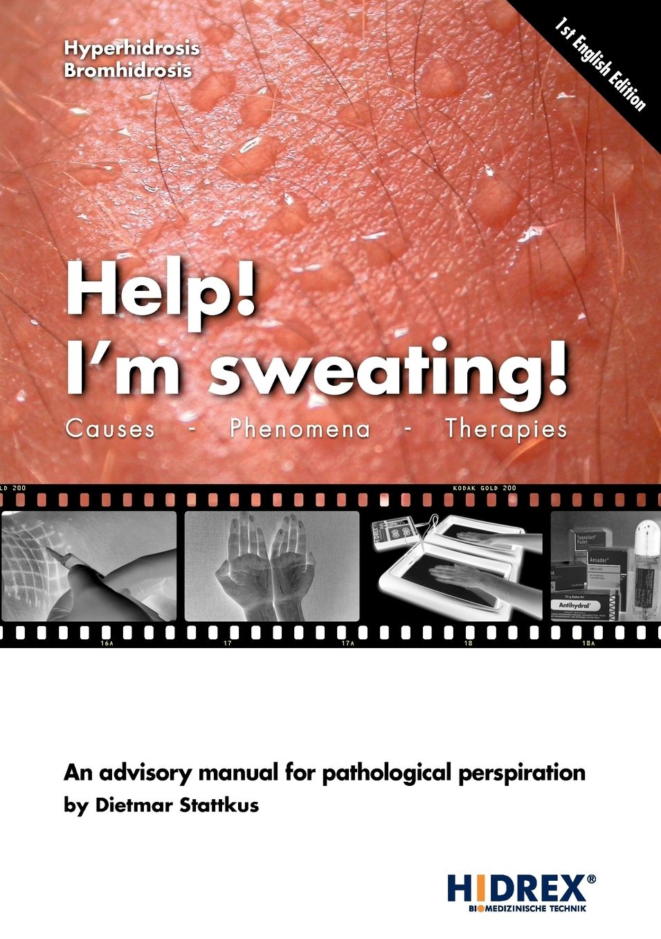 Help! I'M Sweating!