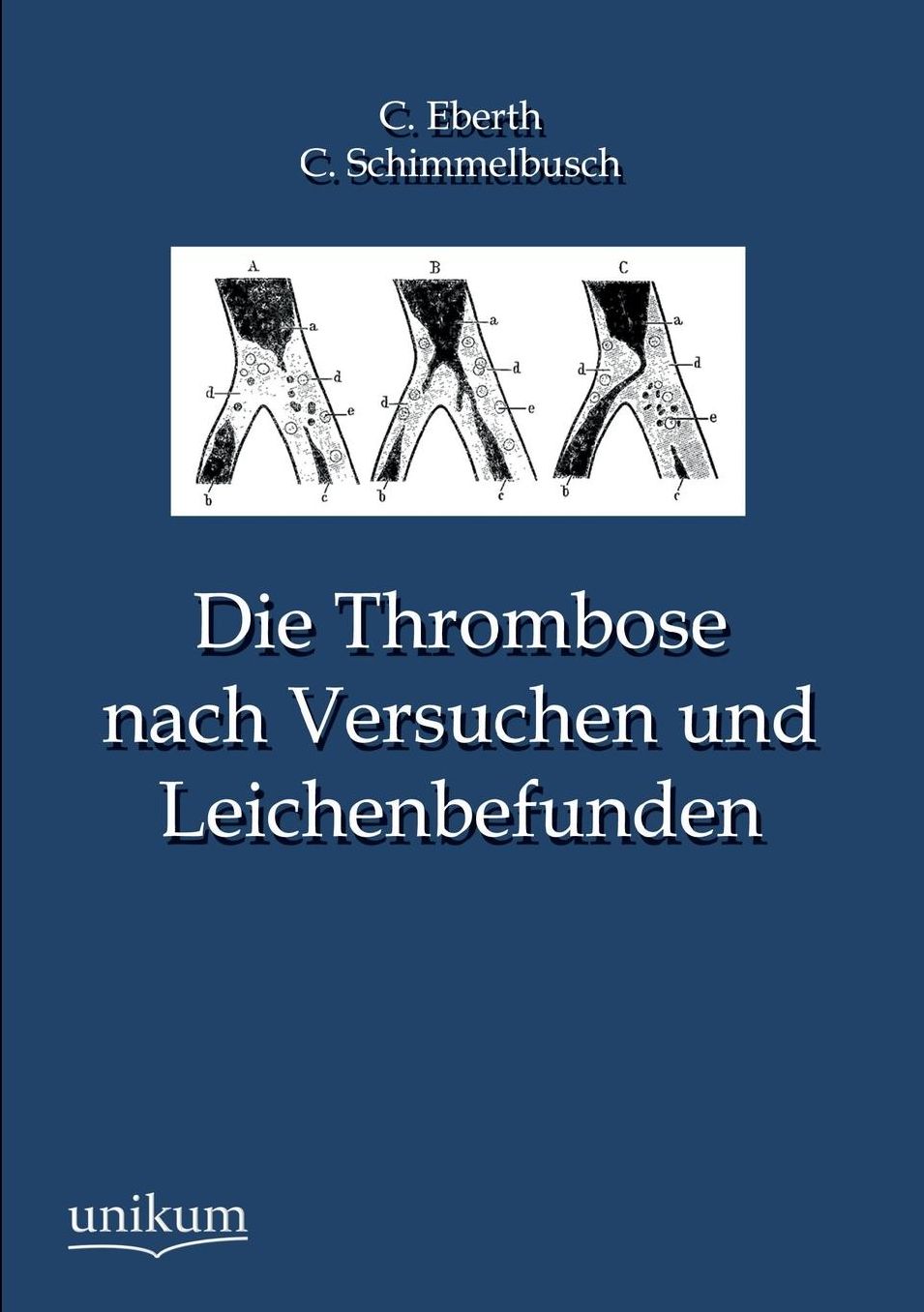 Die Thrombose Nach Versuchen Und Leichenbefunden