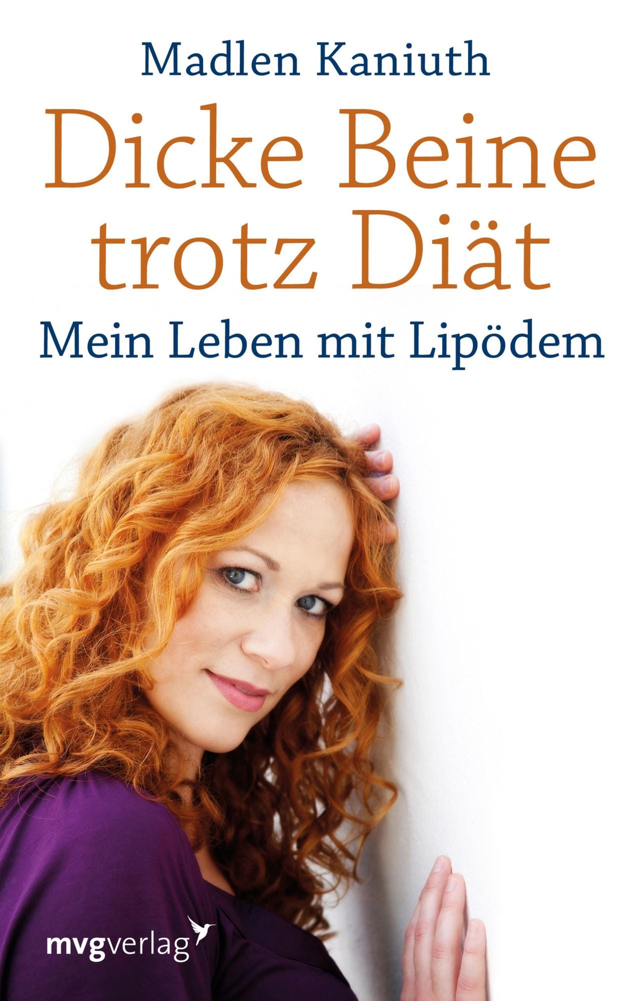Dicke Beine trotz Diät: Mein Leben mit Lipödem