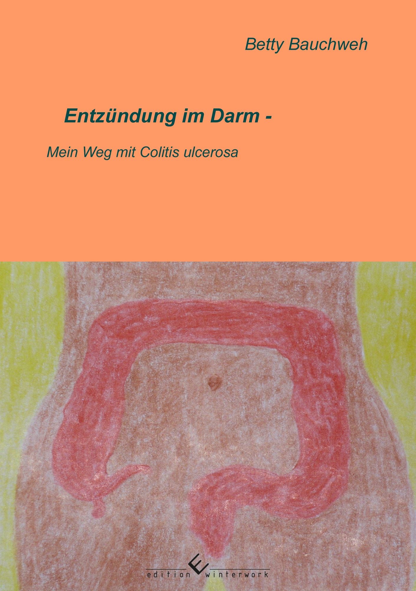 Entzündung im Darm - Mein Weg mit Colitis ulcerosa