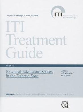 ITI Treatment Guide, Vol 6: Extended Edentulous Spaces in the Esthetic Zone