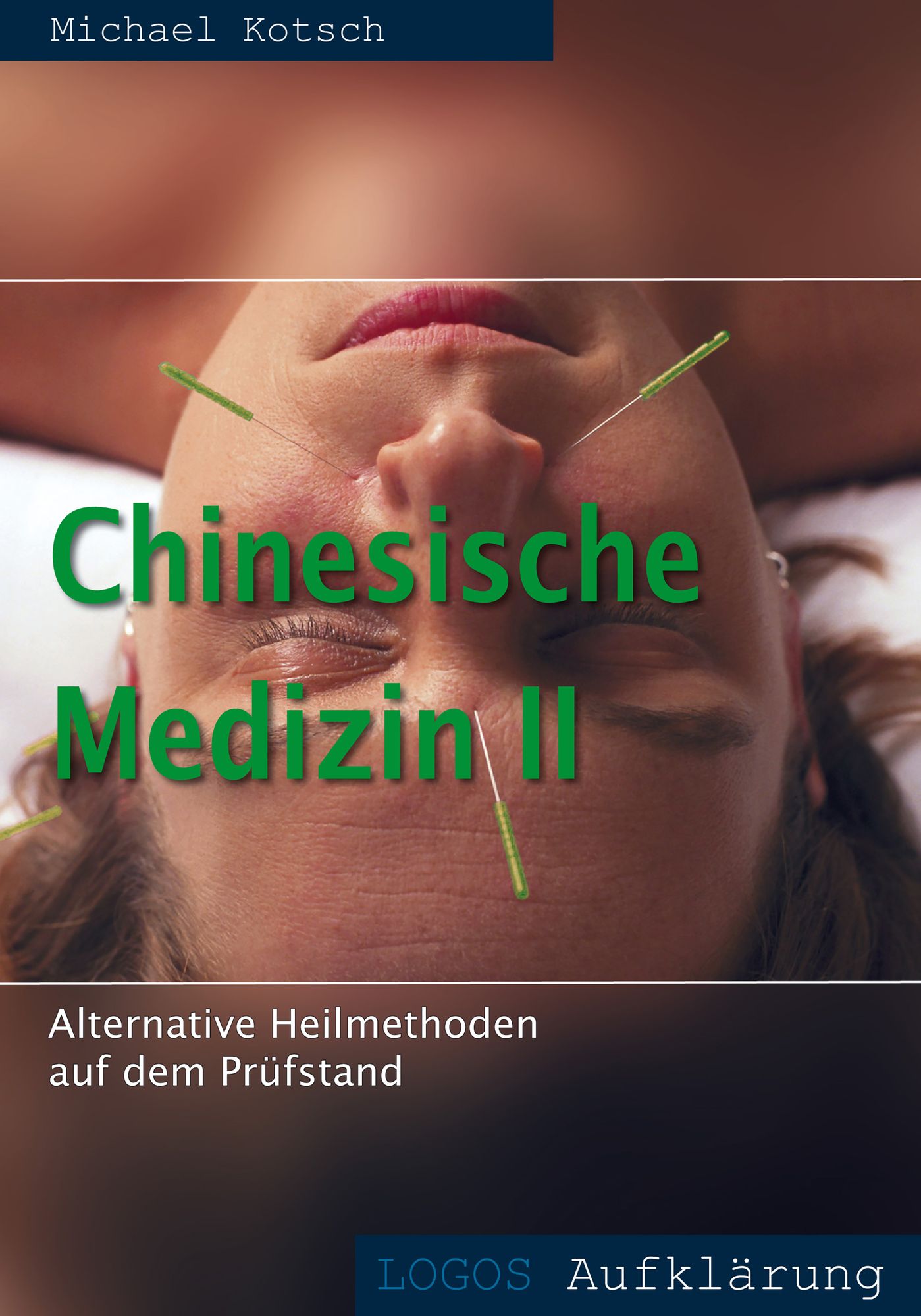 Chinesische Medizin: Alternative Heilmethode auf dem Prüfstand: Akupunktur, Feng Shui, Qi Gong, Aikido