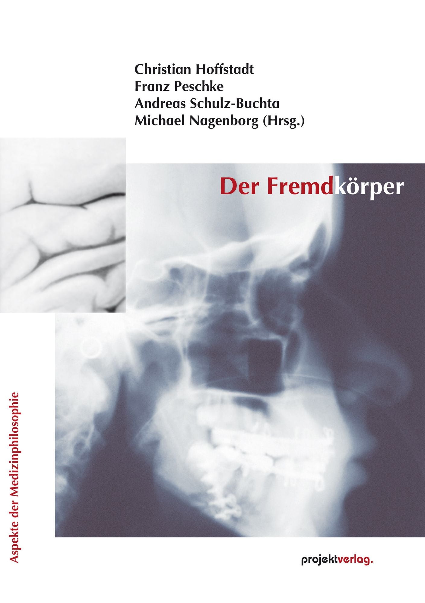 Der Fremdkörper