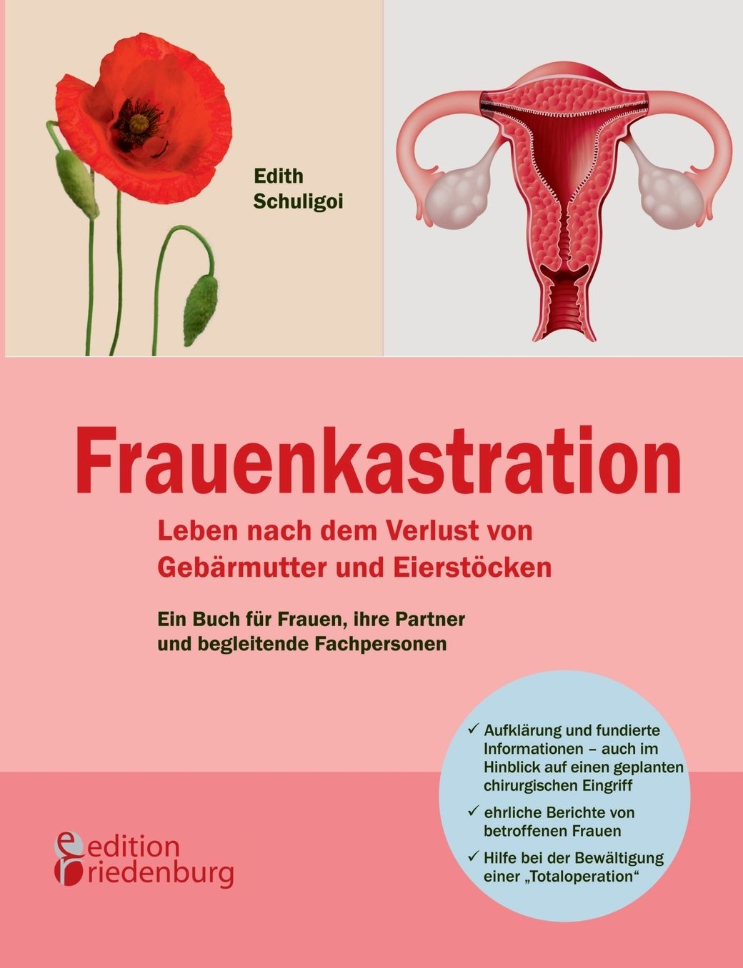 Frauenkastration - Leben nach dem Verlust von Geb rmutter und Eierst cken: Ein Buch f r Frauen, ihre Partner und begleitende Fachpersonen