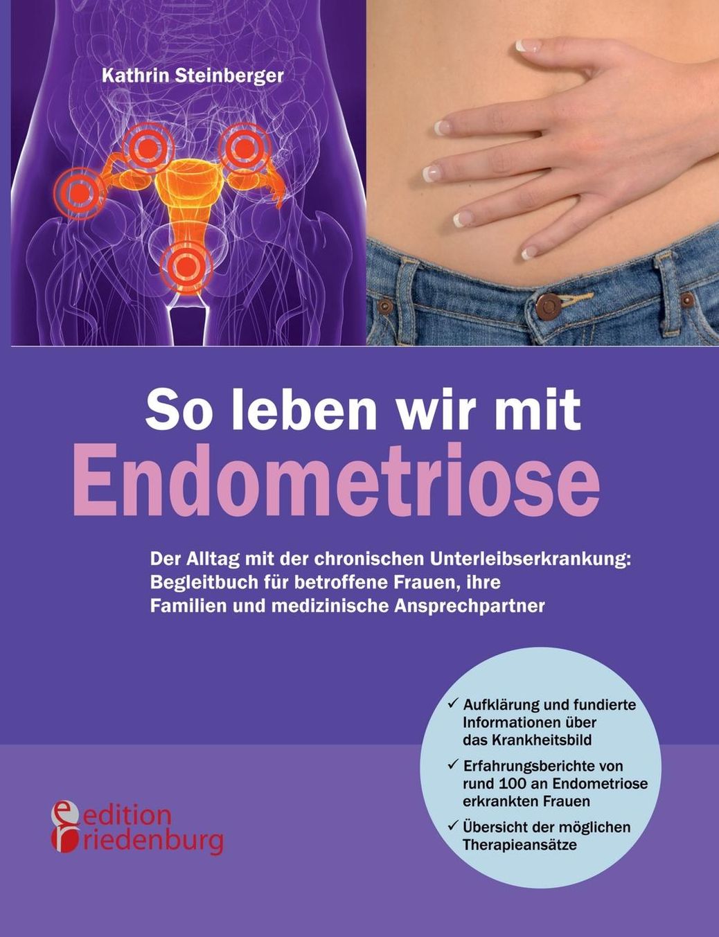 So leben wir mit Endometriose - Der Alltag mit der chronischen Unterleibserkrankung: Begleitbuch f r betroffene Frauen, ihre Familien und medizinische Ansprechpartner