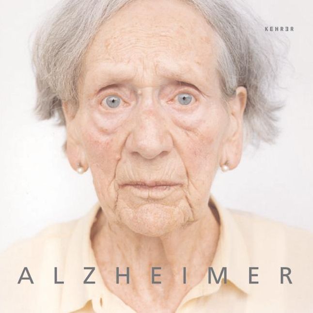 Alzheimer