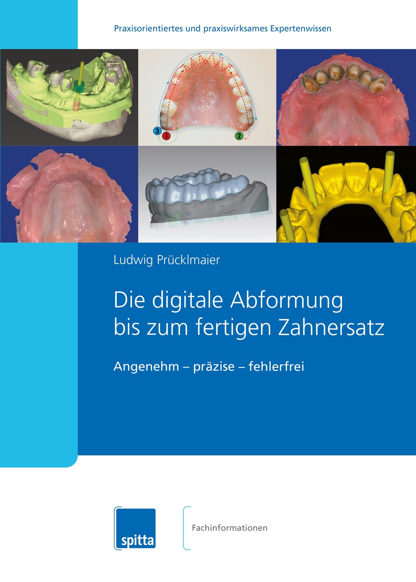 Die digitale Abformung bis zum fertigen Zahnersatz: Angenehm ? präzise ? fehlerfrei