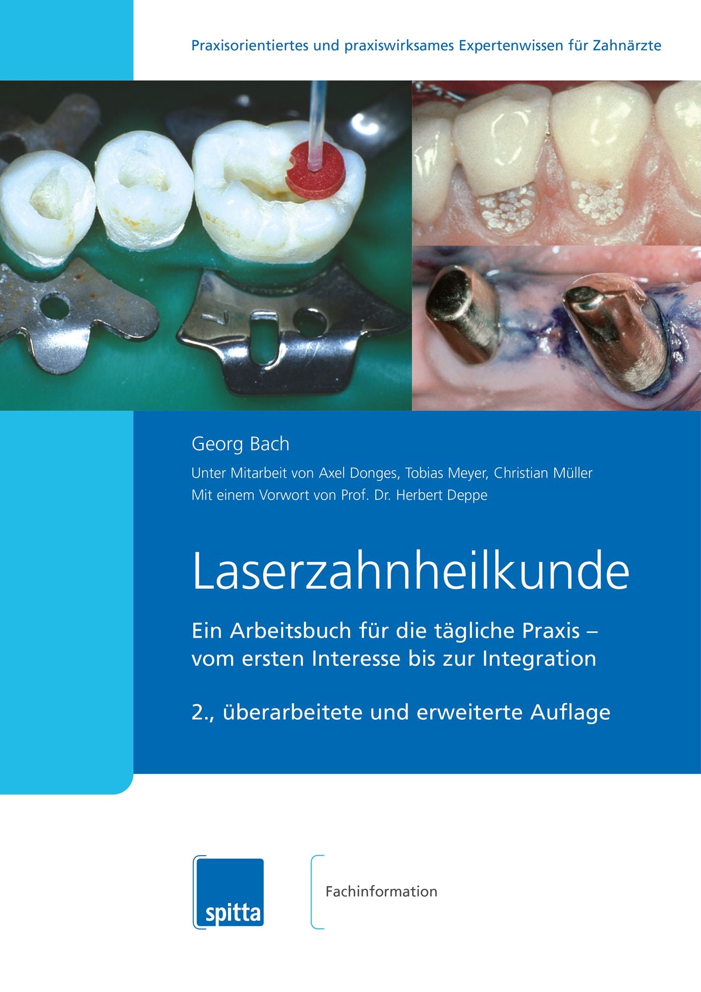 Laserzahnheilkunde: Ein Arbeitsbuch für die tägliche Praxis ? vom ersten Interesse bis zur Integration
