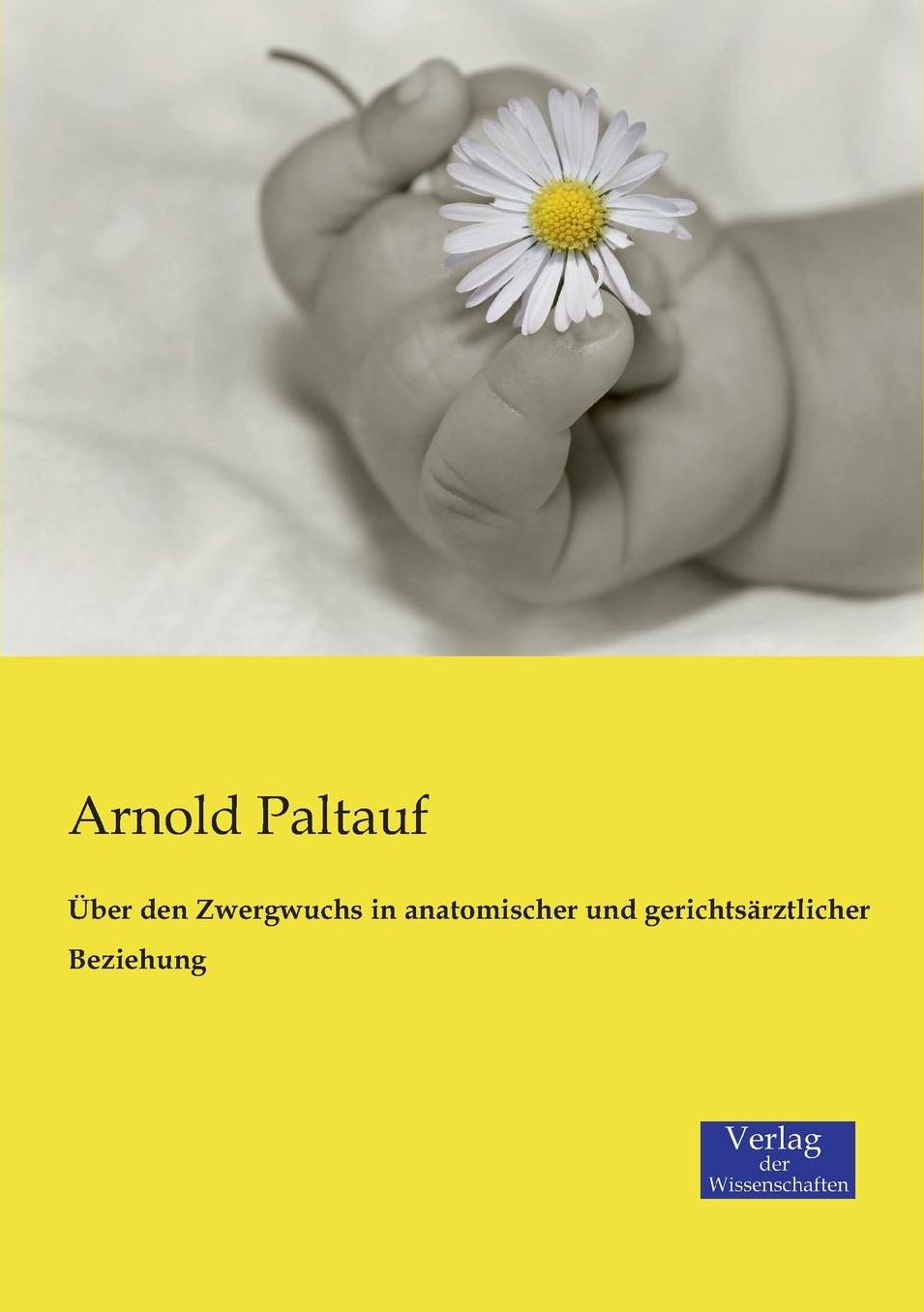 ber den Zwergwuchs in anatomischer und gerichts rztlicher Beziehung