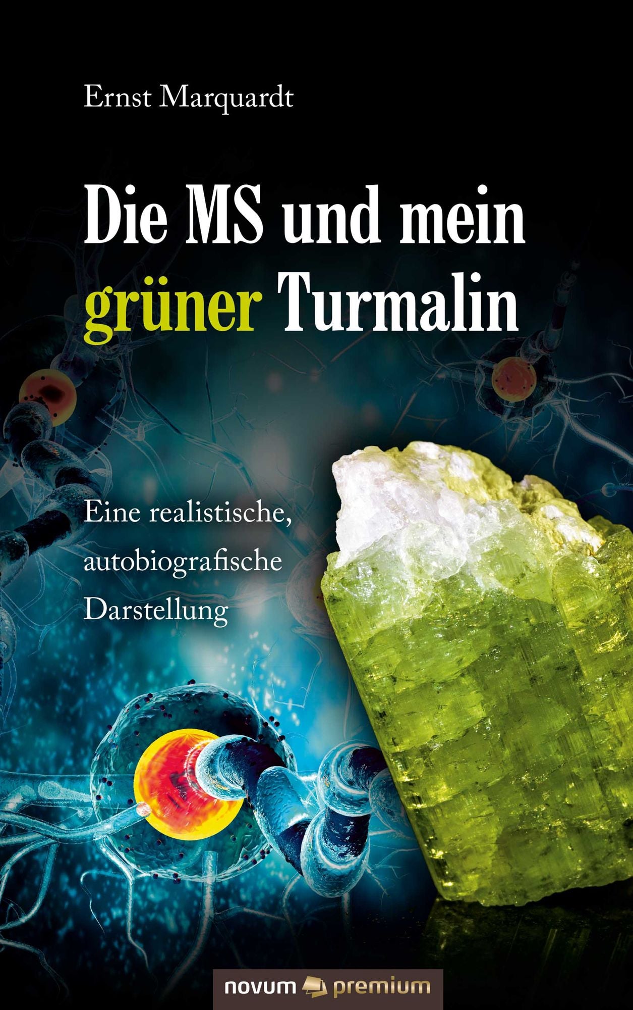 Die MS und mein grüner Turmalin: Eine realistische, autobiografische Darstellung