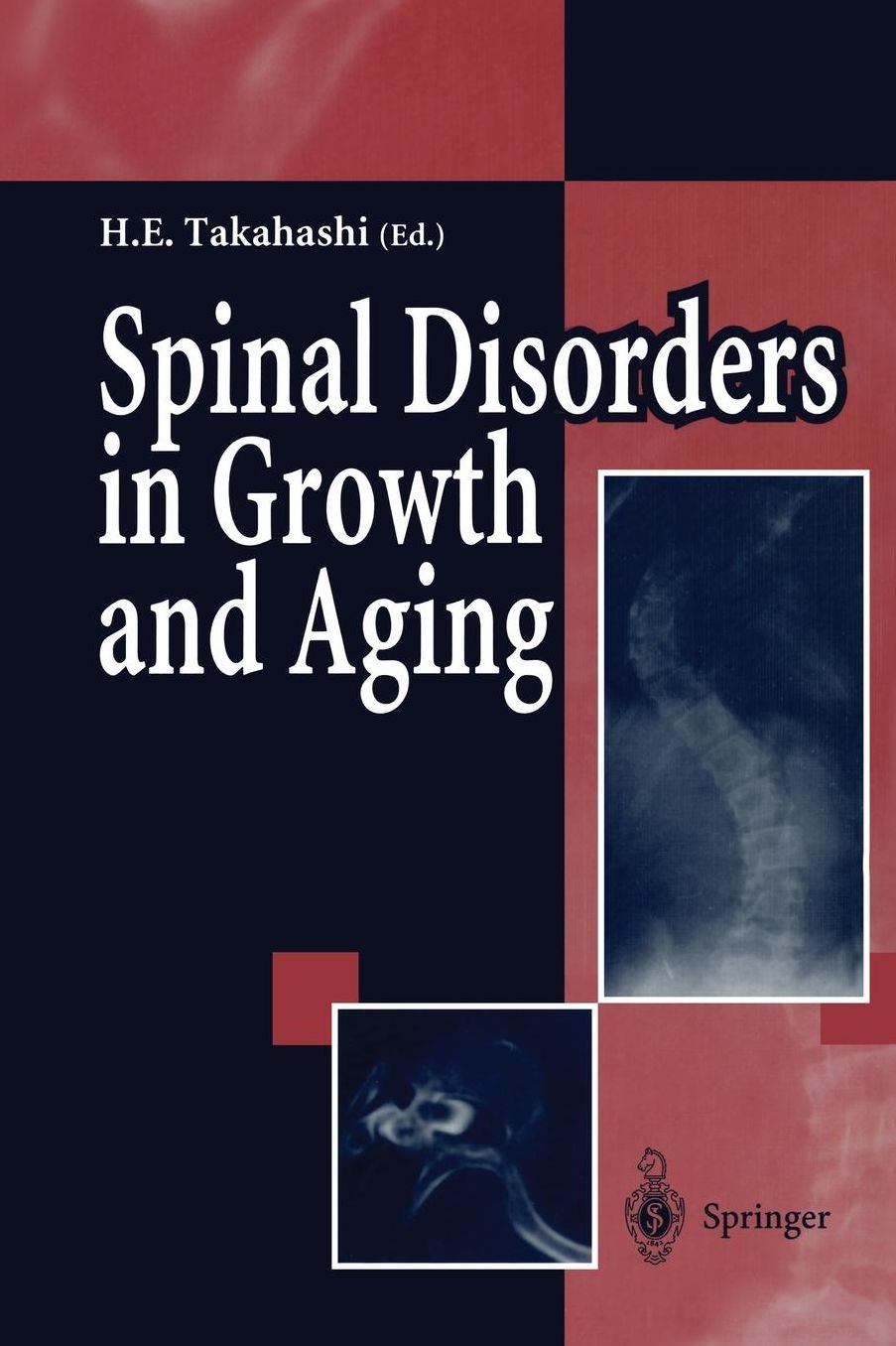 Spinal Disorders in Growth and Aging