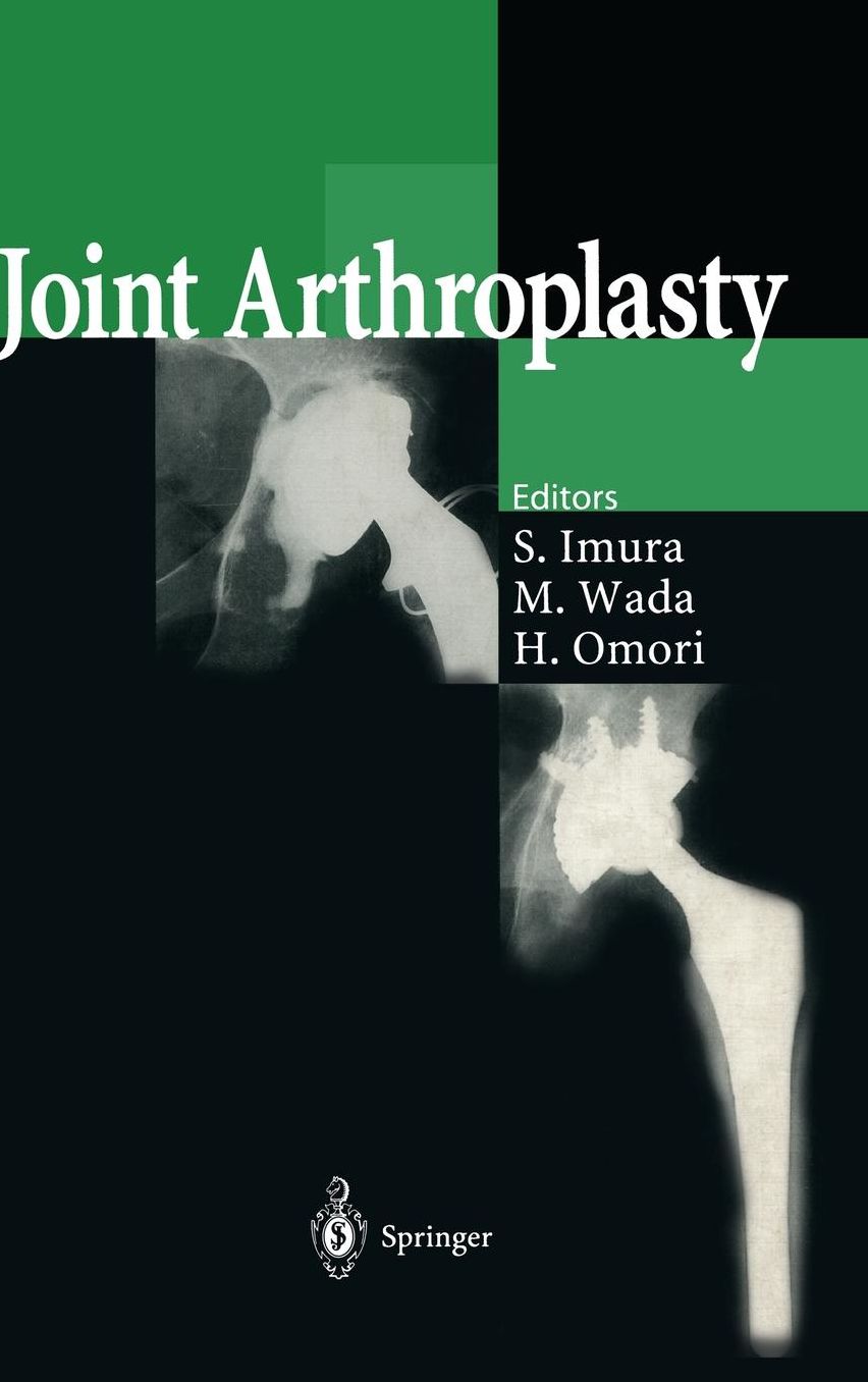 Joint Arthroplasty