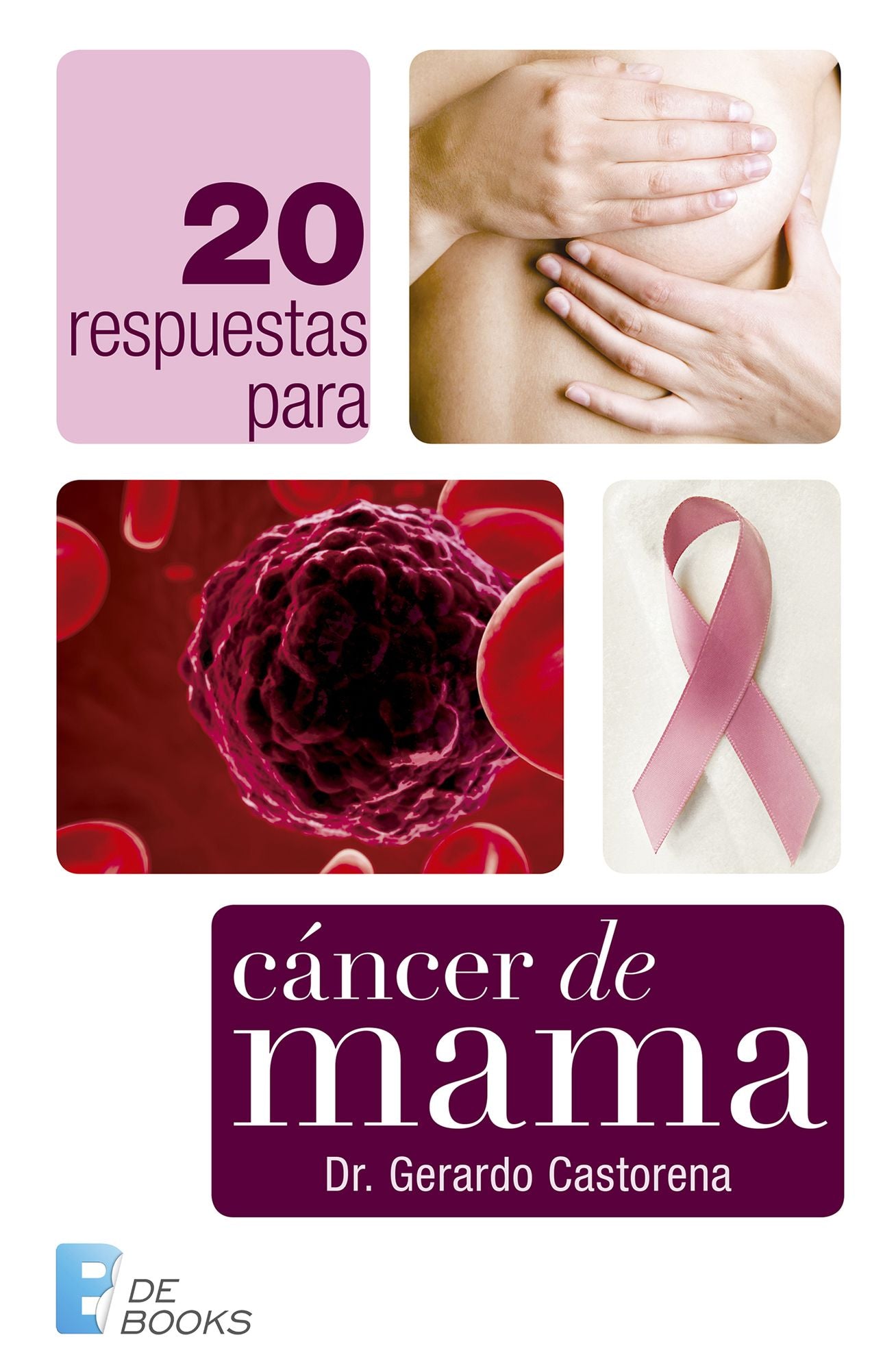 20 Respuestas para cáncer de mama