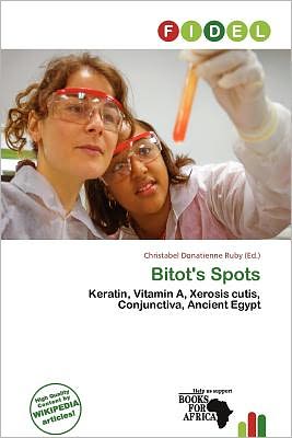 Bitot's Spots