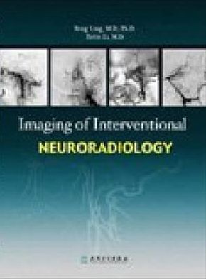 Imaging of Interventional Neuroradiology