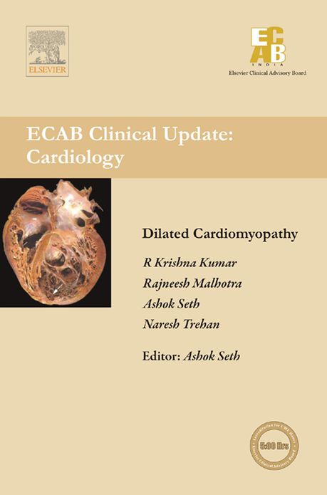 Dilated Cardiomyopathy - ECAB