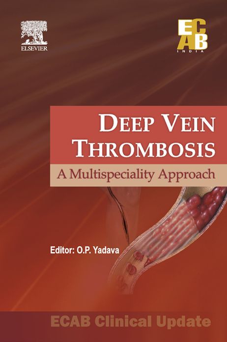 Deep Vein Thrombosis - ECAB