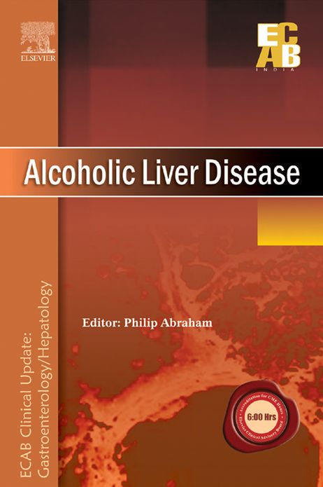 Alcoholic Liver Disease - ECAB