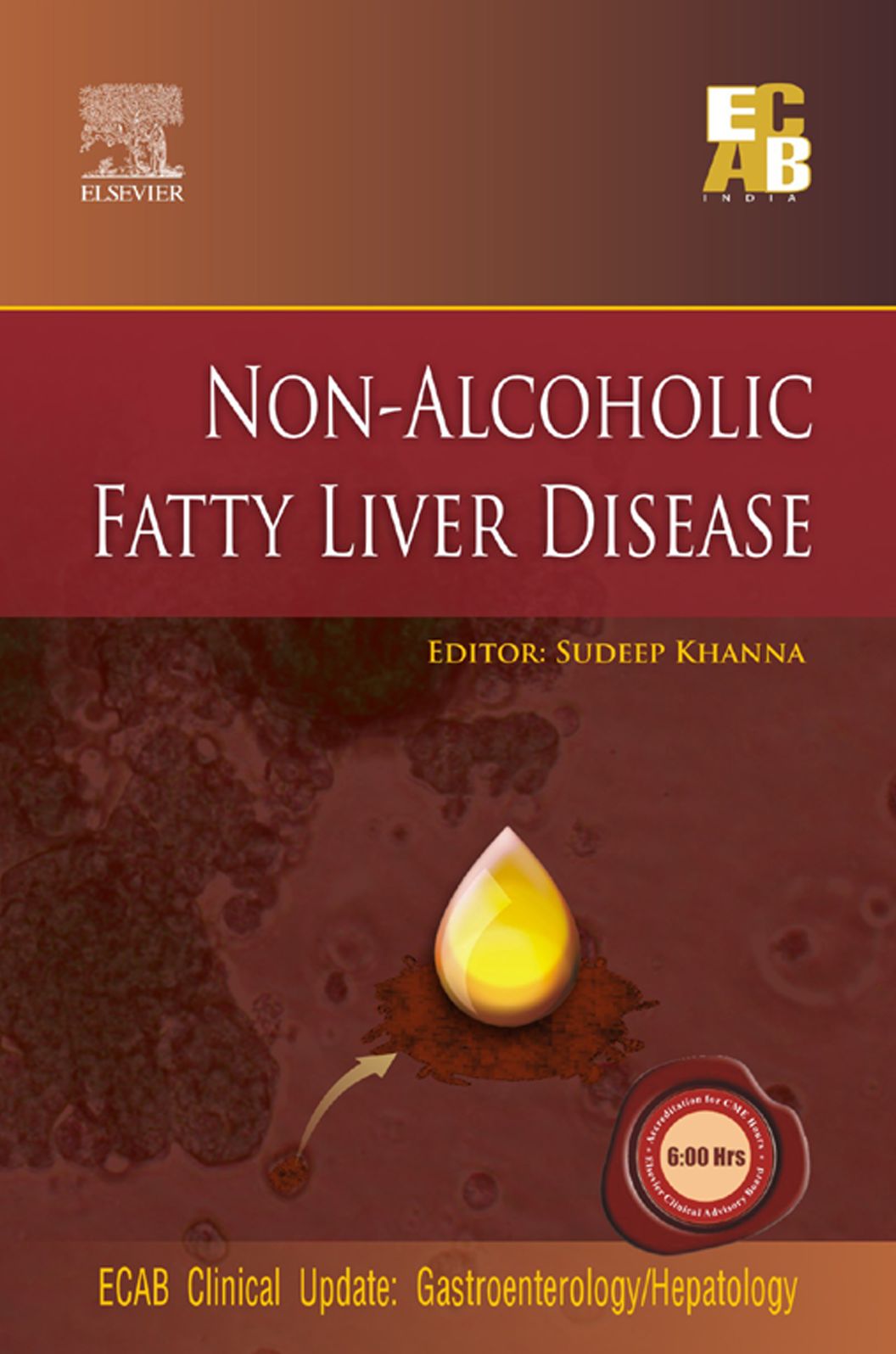 Non-Alcoholic Fatty Liver Disease - ECAB