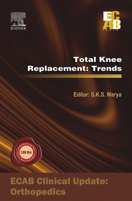 Total Knee Replacement: Trends - ECAB
