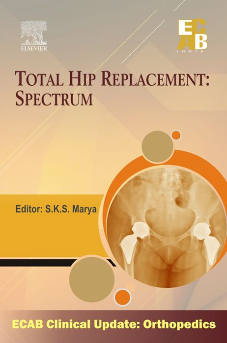 Total Hip Replacement Spectrum - ECAB