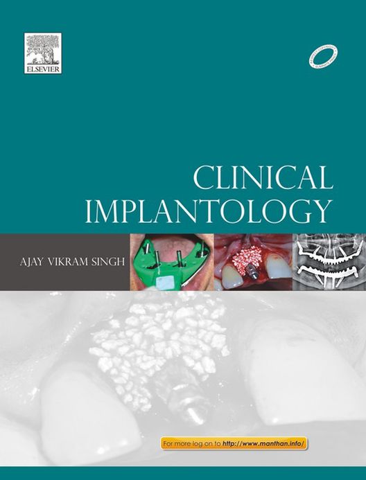 Clinical Implantology - E-Book