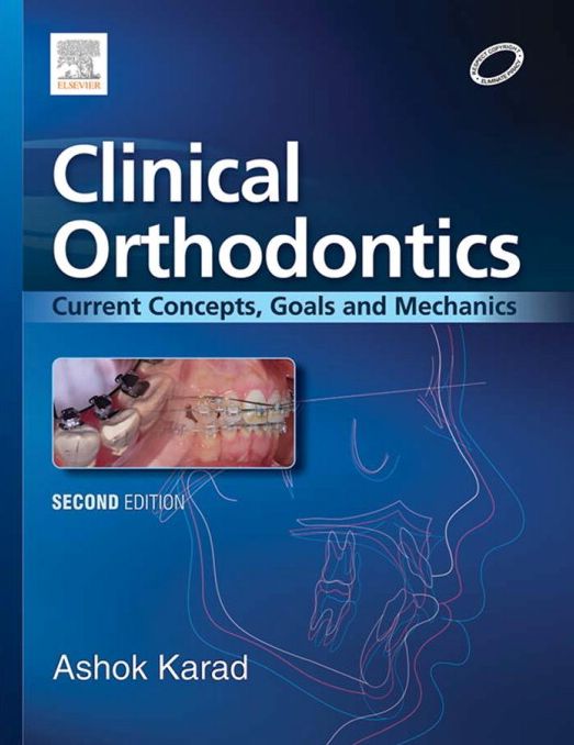 Clinical Orthodontics: Current Concepts, Goals and Mechanics - E-Book
