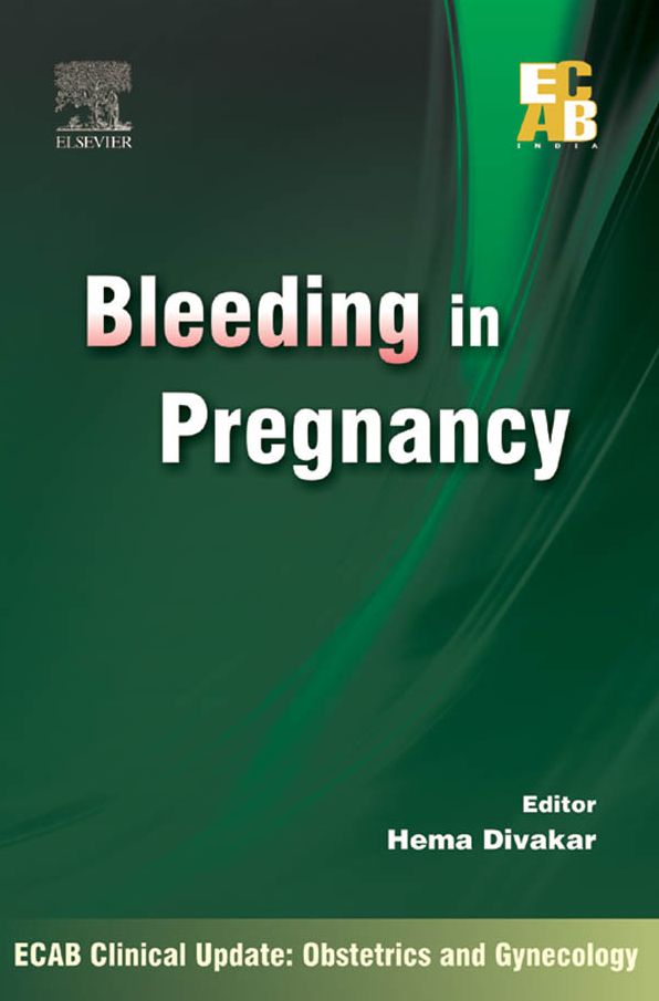 Bleeding in Pregnancy - ECAB - E-Book