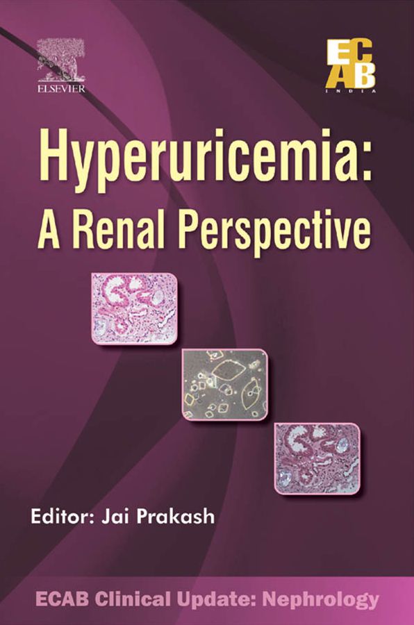 Hyperuricemia: A Renal Perspective - ECAB - E-Book
