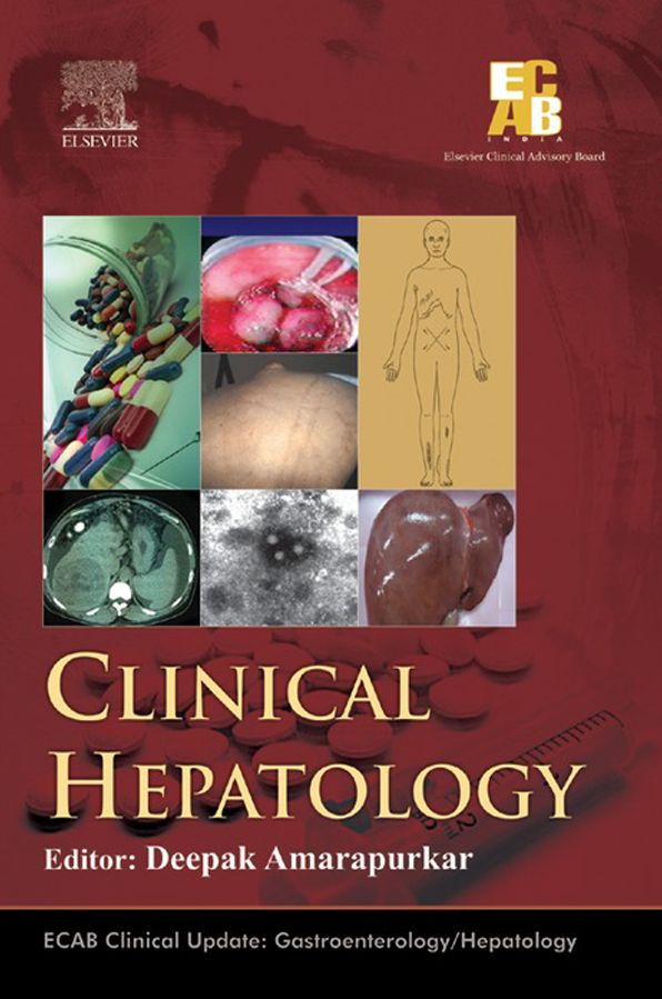 ECAB Clinical Hepatology - E-Book