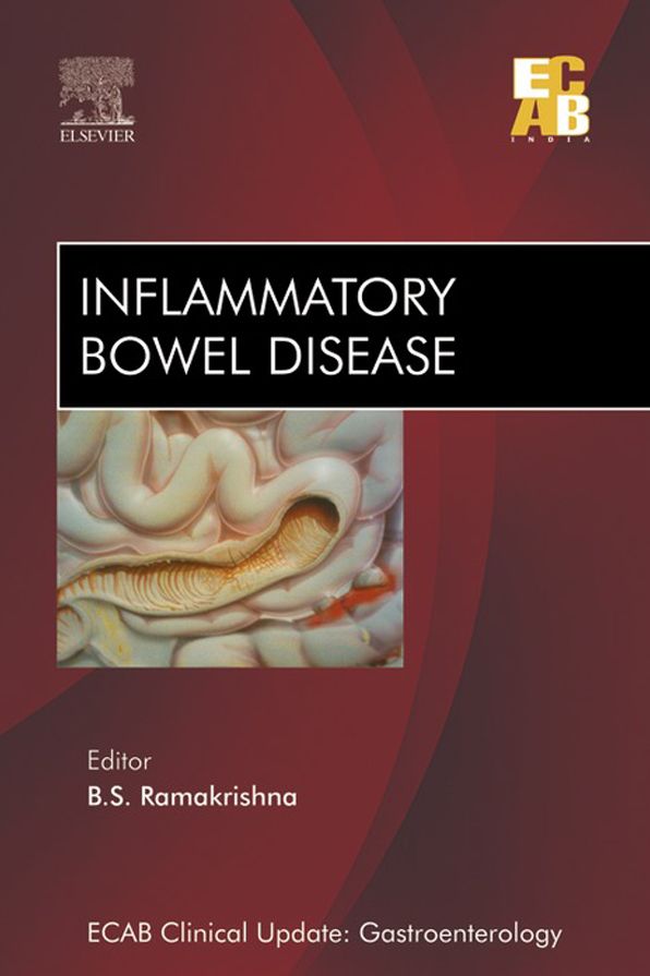 ECAB Inflammatory Bowel Disease - E-Book