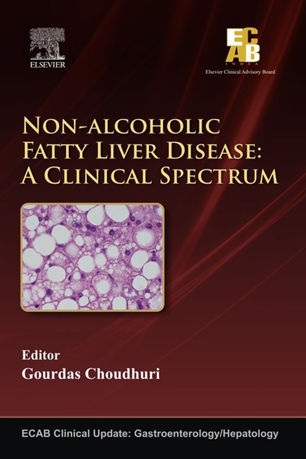 ECAB Non-alcoholic Fatty Liver Disease - E-Book