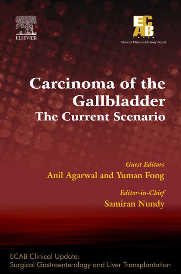 Carcinoma of the Gallbladder: The Current Scenario - ECAB - E-Book